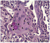 Histology of mouse lung showing a giant cell containing Histoplasma macroconidia next to Histoplasma microconidia and yeast cells.