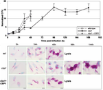 Micrographs of macrophages filled with cbp1 mutant Histoplasma