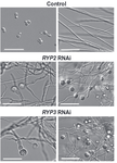 Micrographs of wild type (WT), ryp2 RNAi, and ryp3 RNAi strains of Histoplasma at 37C and room temperature (RT).  WT is yeast at 37C and hyphae at RT, whereas the RNAi strains are hyphae at both temperatures.  Additionally, the RNAi strains show increased conidiation at RT.