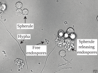 Micrograph of Coccidioides posadasii Silveira showing spherules, hyphae, and spherules releasing endospores.