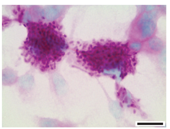 Micrograph of macrophages filled with cbp1 mutant Histoplasma